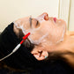 EGF Peptide Treatment