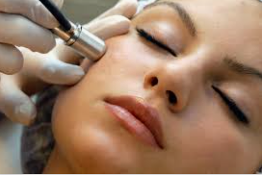 Microderm Abrasion Extend