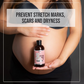 STRETCHMARK OIL