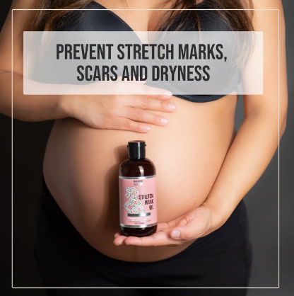 STRETCHMARK OIL